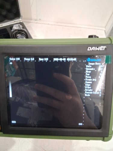 Dawei Vet HANDHELD PORTABLE Scanner B-Ultra Sound MACHINE - 3.5mhz - green (model: 50) image 7