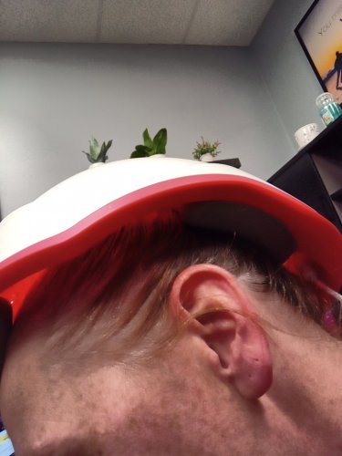iRestore Laser Hair Growth System - FDA Cleared for Men and Women image 9