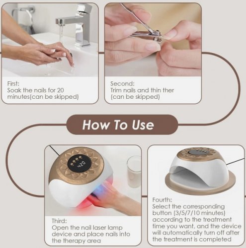 NAIL CLEANING LASER DEVICE for anti fungal infection WITH DIGITAL DISPLAY for professional use - WHITE/GOLD (Model: KJWGG20241101-US-Y) image 2