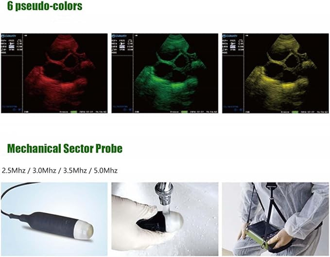 Dawei Vet HANDHELD PORTABLE Scanner B-Ultra Sound MACHINE - 3.5mhz - green (model: 50) image 2