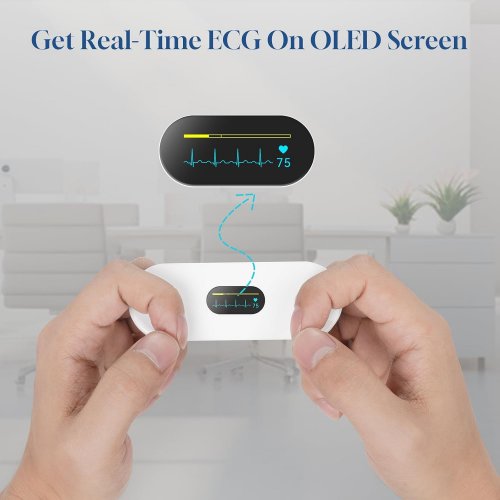 Checkme ECG/EKG Monitor with Chest Strap - AI Analysis in App, 30s to 15 min Heart Recording, Cardio Mobile Device with Display - Portable Bluetooth Heart Monitor with Rechargeable Battery (MODEL:ER2-S) image 2